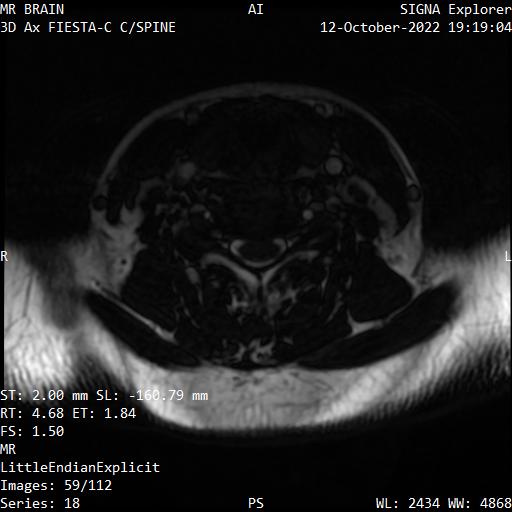 Series 018 image 59