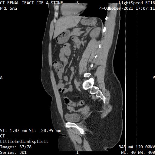 Series 301 image 37