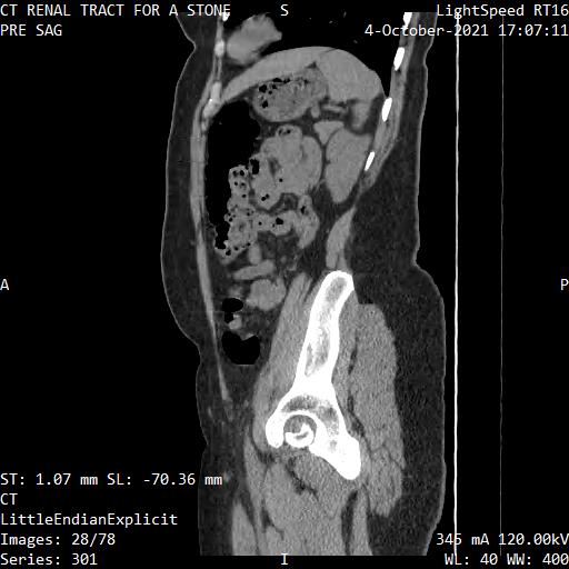 Series 301 image 28