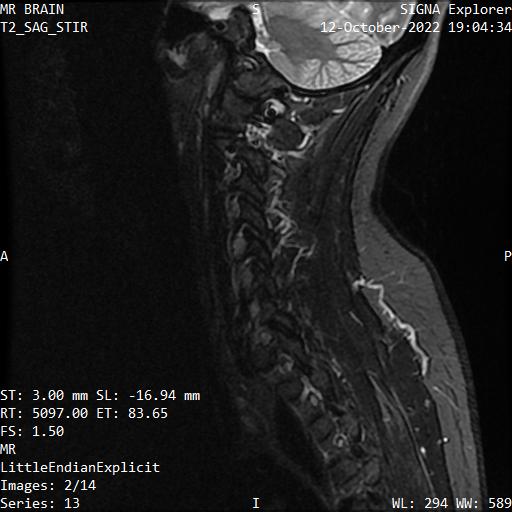 Series 013 image 2