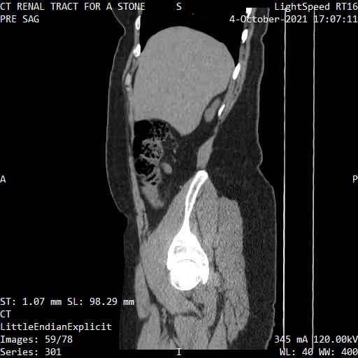Series 301 image 59