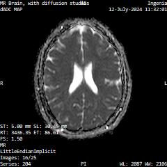Series 204 image 16
