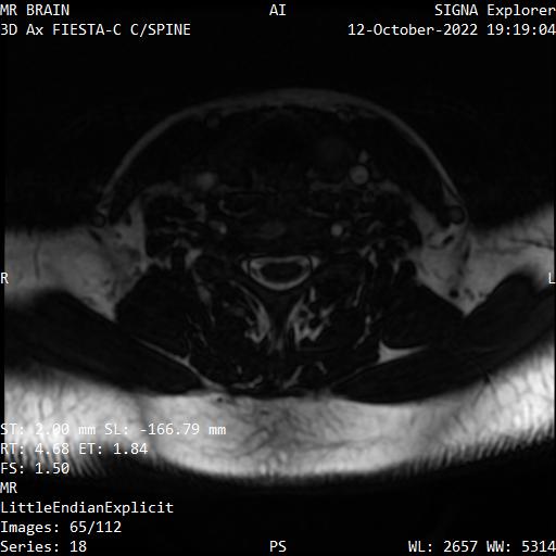 Series 018 image 65