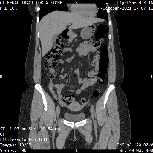 Series 300 image 19
