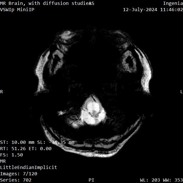 Series 702 image 7