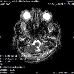 Series 204 image 5