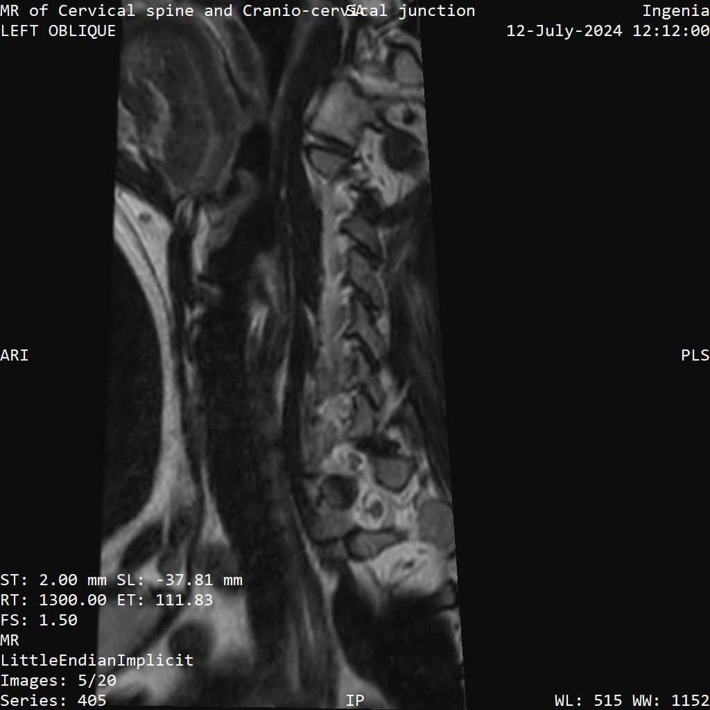 Series 405 image 5