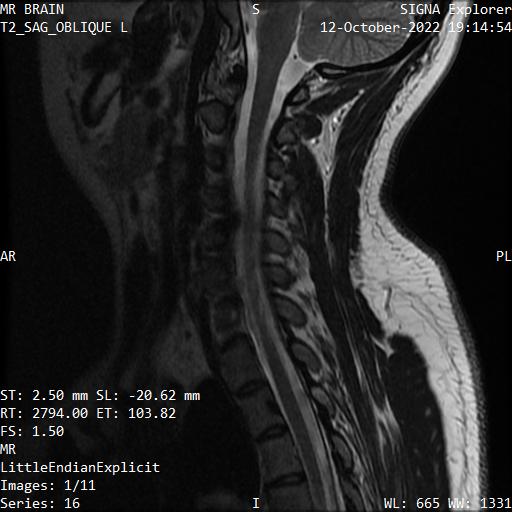 Series 016 image 1