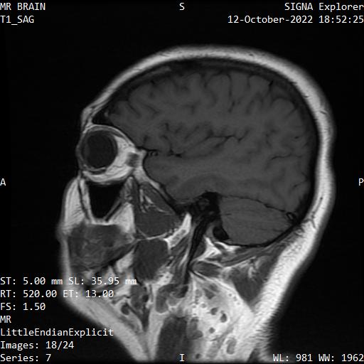 Series 007 image 18