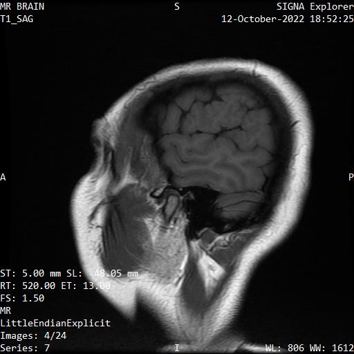 Series 007 image 4