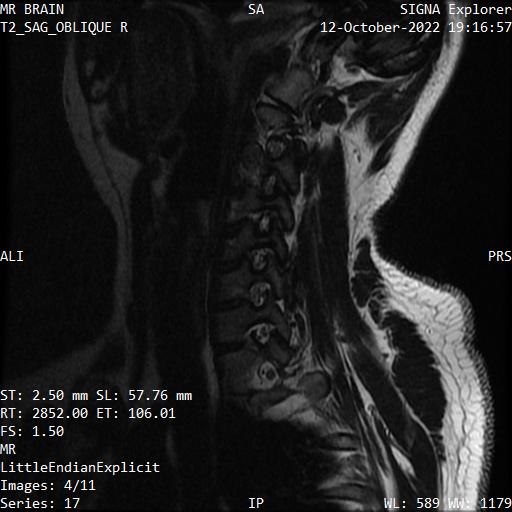 Series 017 image 4