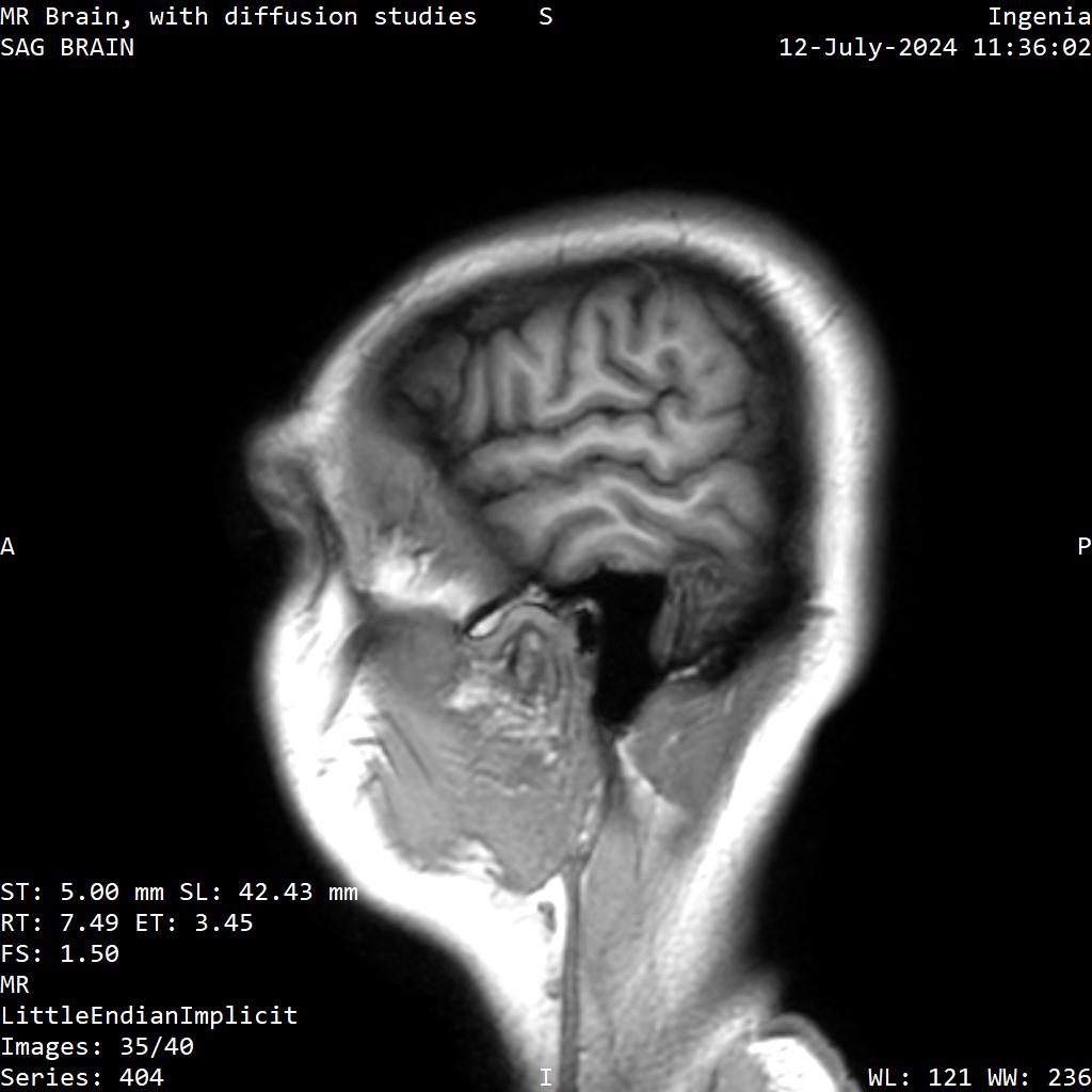 Series 404 image 35