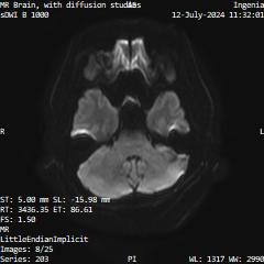 Series 203 image 8