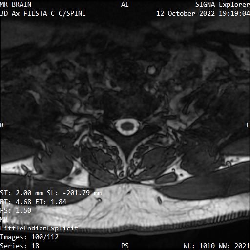 Series 018 image 100