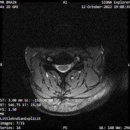 Series 014 image 7