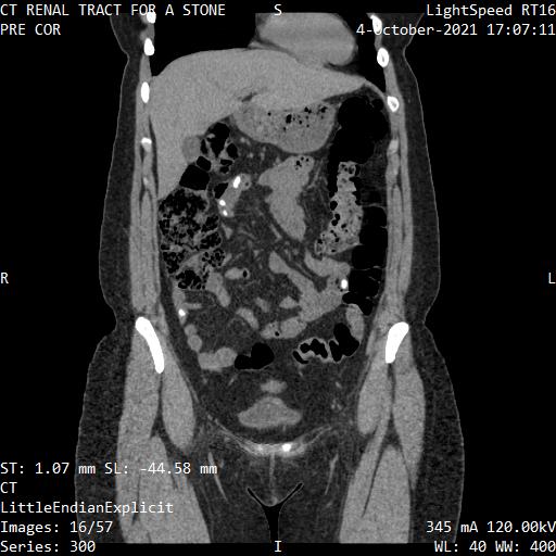 Series 300 image 16
