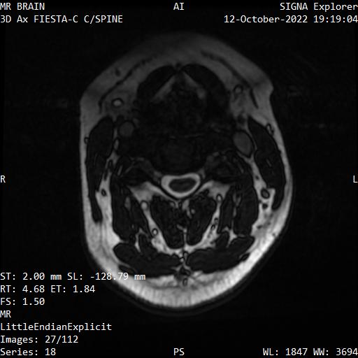 Series 018 image 27