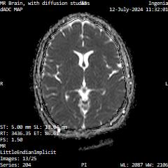 Series 204 image 13
