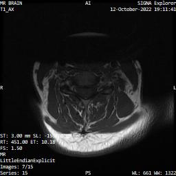 Series 015 image 7