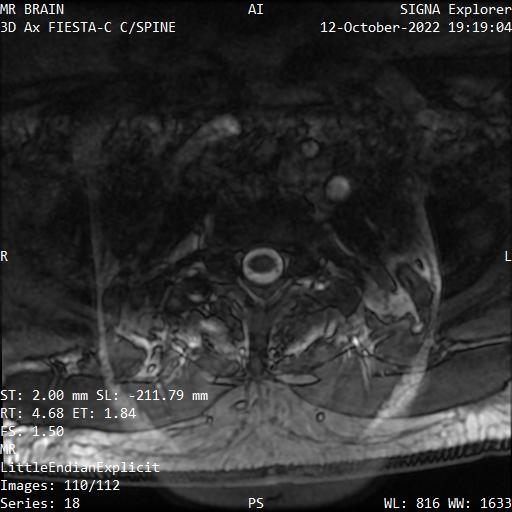Series 018 image 110