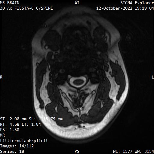 Series 018 image 14