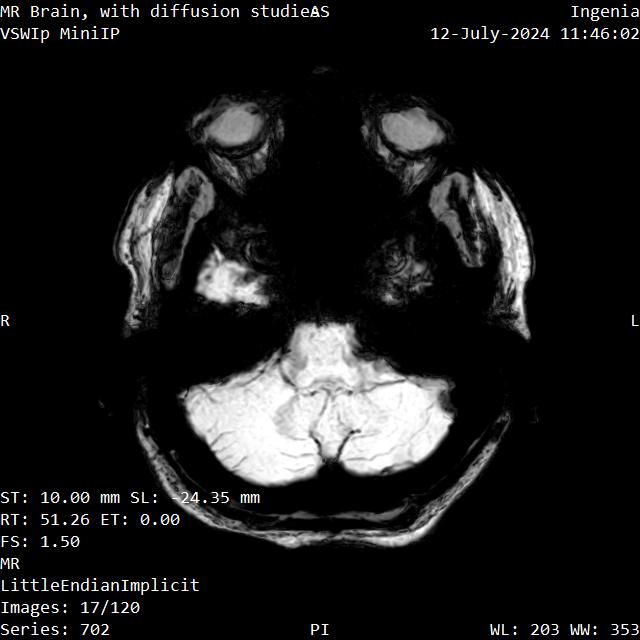 Series 702 image 17