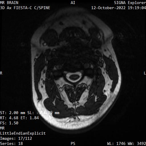 Series 018 image 17