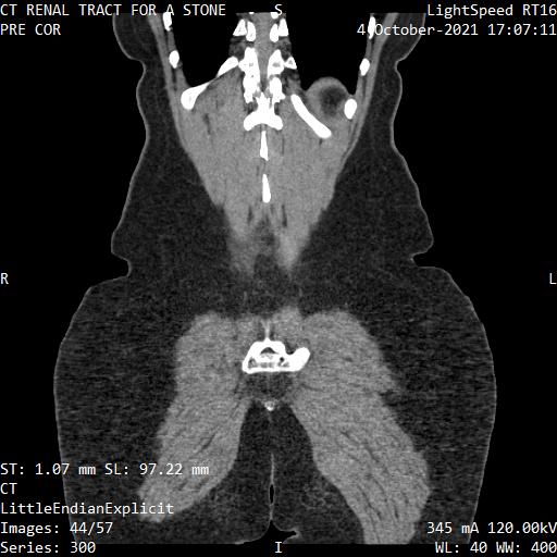 Series 300 image 44