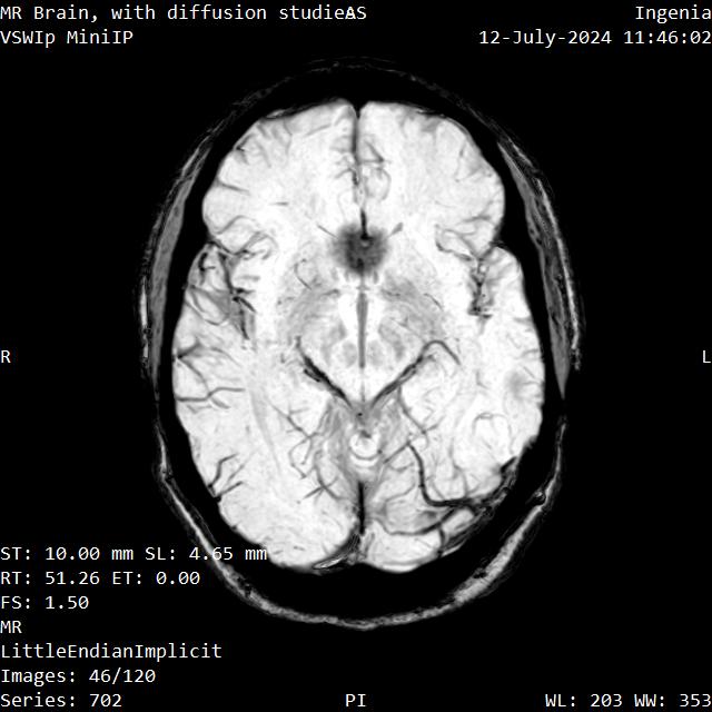 Series 702 image 46