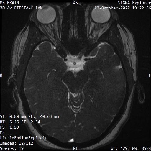 Series 019 image 12