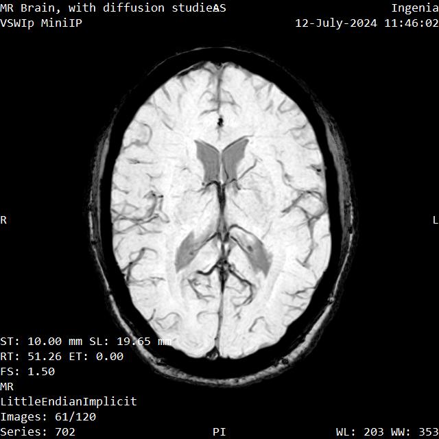 Series 702 image 61