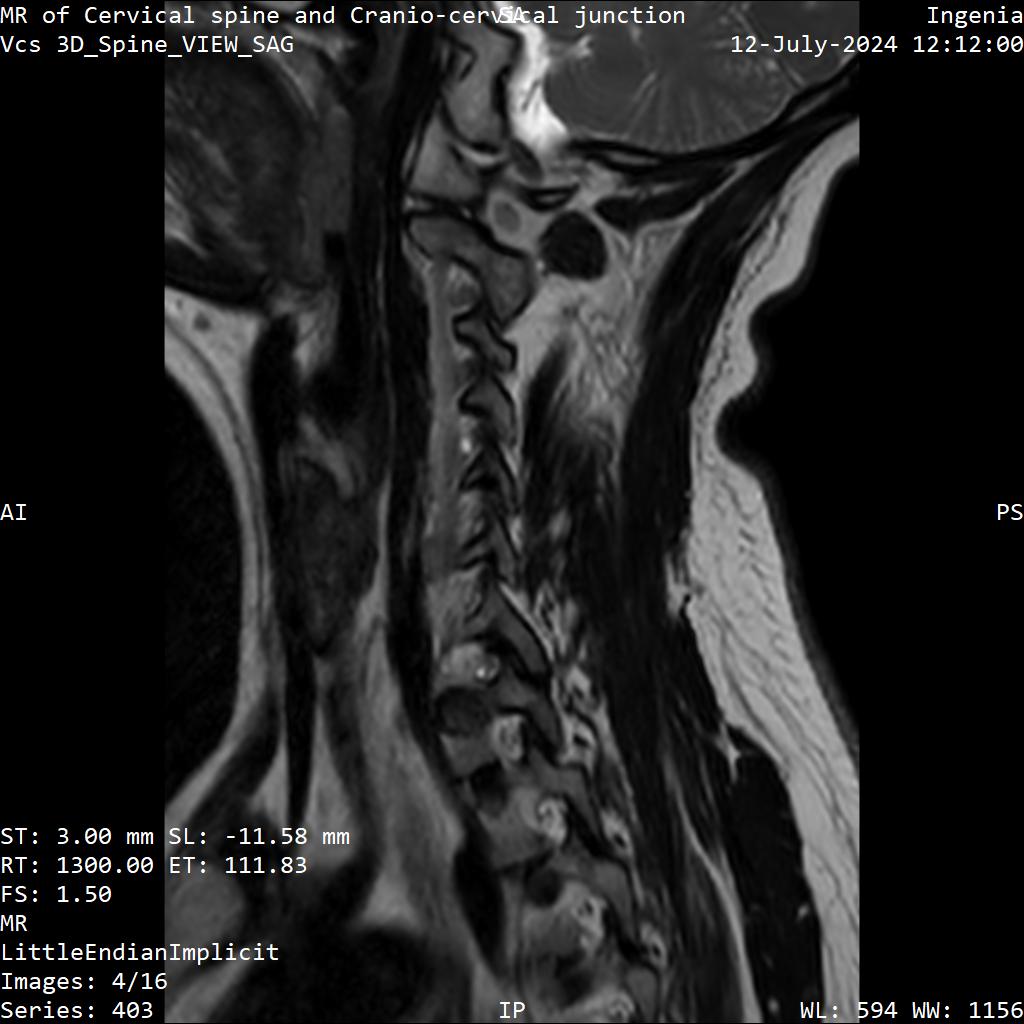 Series 403 image 4