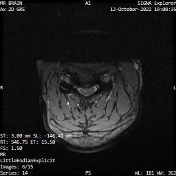 Series 014 image 6