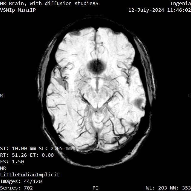 Series 702 image 44