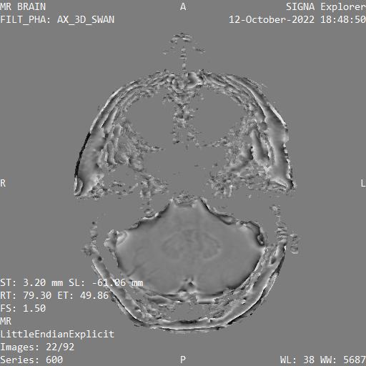 Series 600 image 22