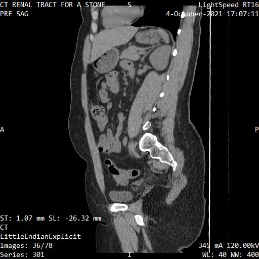 Series 301 image 36