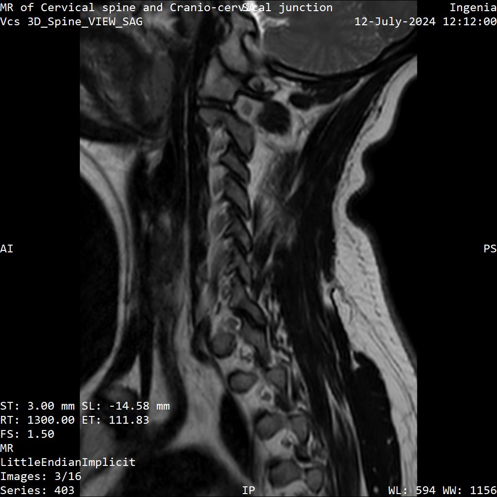 Series 403 image 3