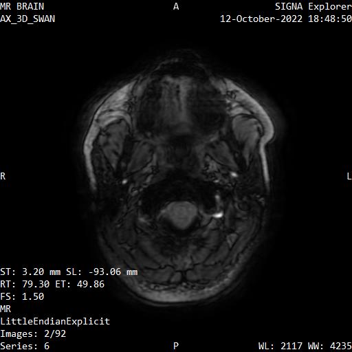 Series 006 image 2