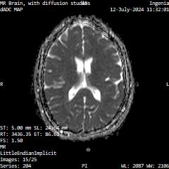 Series 204 image 15