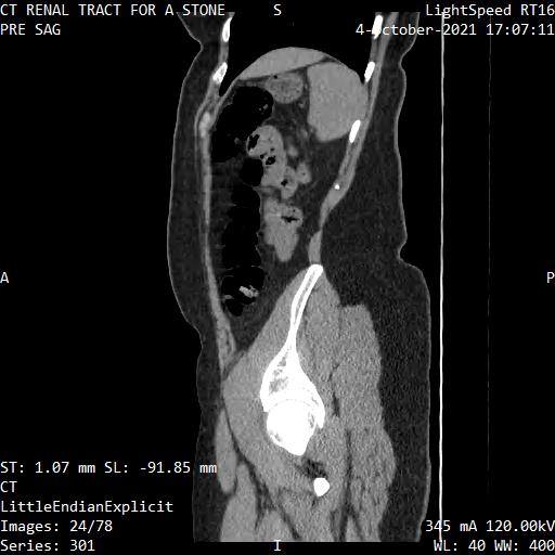 Series 301 image 24