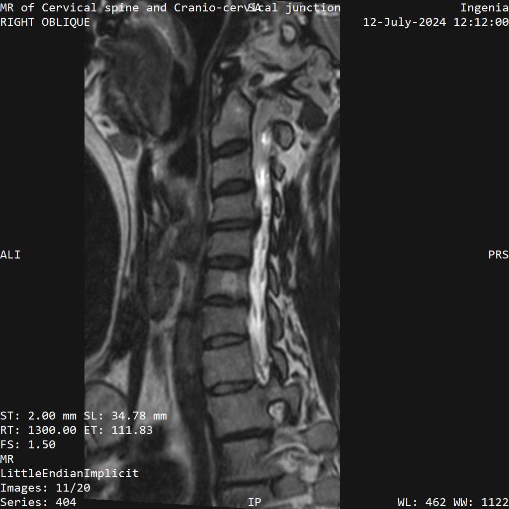 Series 404 image 11