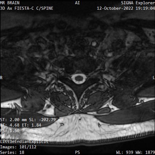 Series 018 image 101