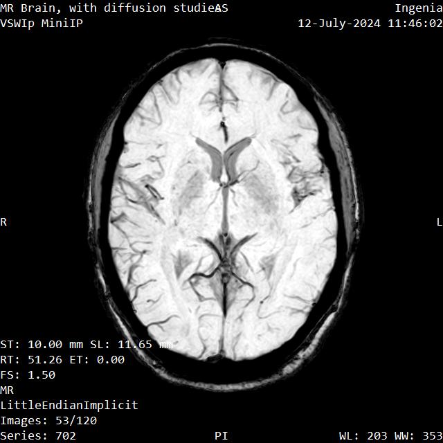 Series 702 image 53