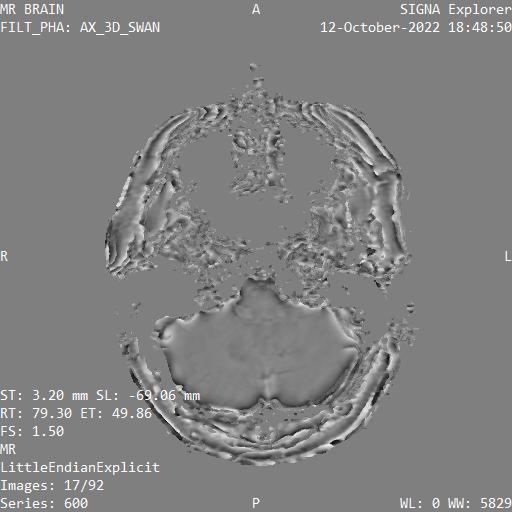 Series 600 image 17