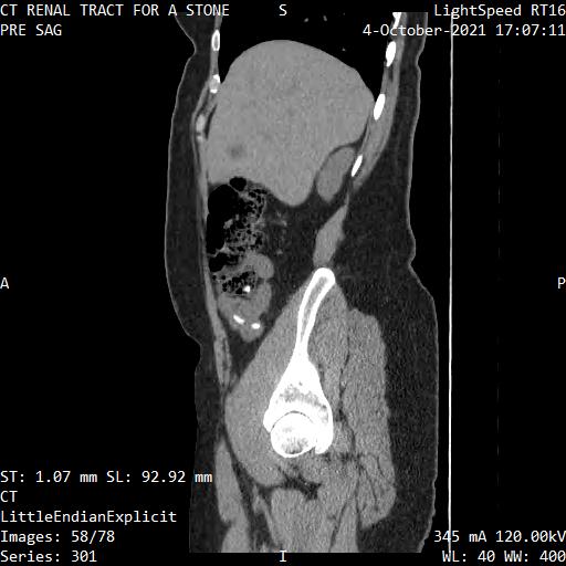 Series 301 image 58