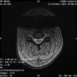 Series 014 image 2