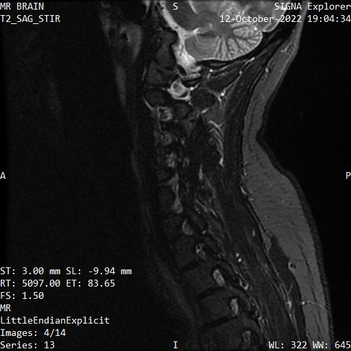 Series 013 image 4