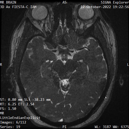 Series 019 image 6