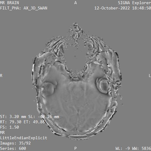 Series 600 image 35
