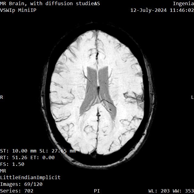 Series 702 image 69